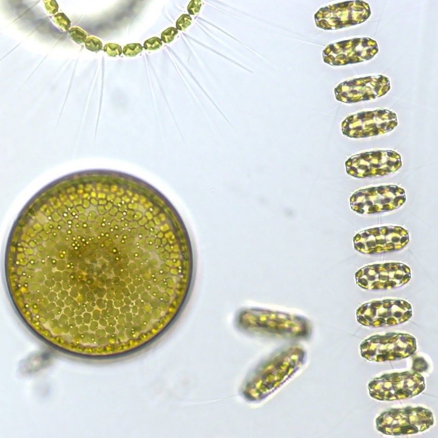 Optical micrograph of diatoms — fossilized aquatic silica skeletons